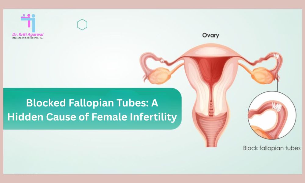 Blocked Fallopian Tubes: A Hidden Cause of Female Infertility | Dr ...